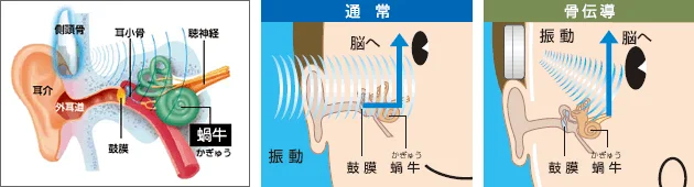 骨伝導の技術を活用して、困っている人の役に立ちたい（ゴールデン